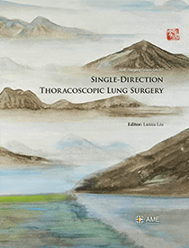 Single-Direction Thoracoscopic Lung Surgery