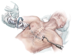 Click on image to zoom