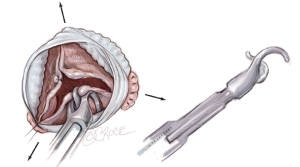 Click on image to zoom