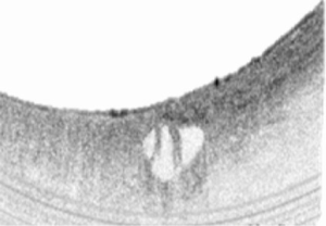 Click on image to zoom