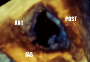 Click on image to zoom
