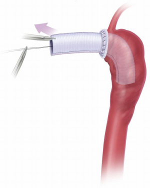 Click on image to zoom