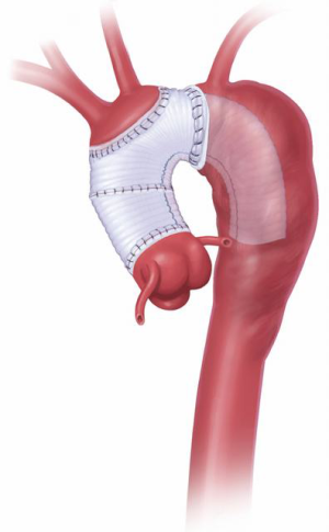 Click on image to zoom