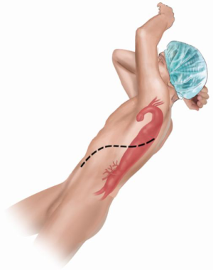 Click on image to zoom