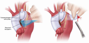 Click on image to zoom