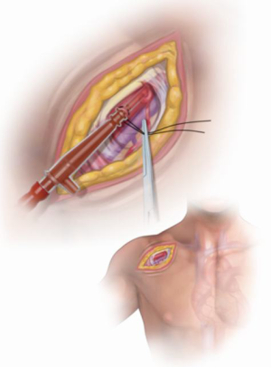 Click on image to zoom