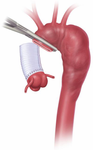 Click on image to zoom