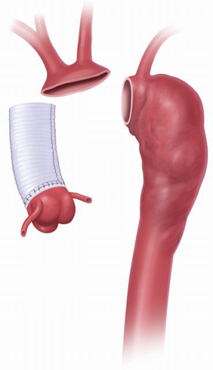 Click on image to zoom