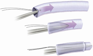 Click on image to zoom