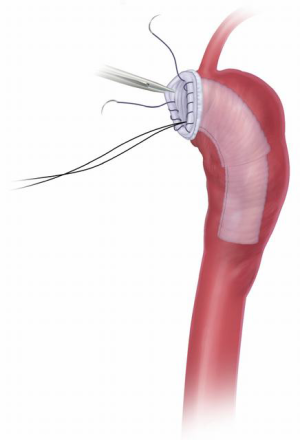 Click on image to zoom