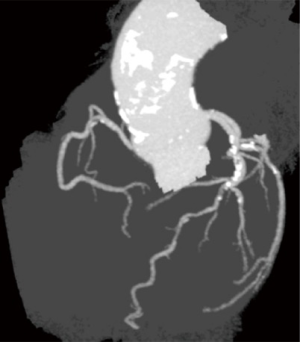 Click on image to zoom