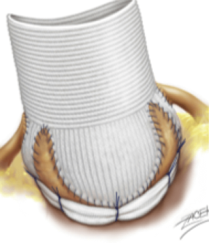 Click on image to zoom