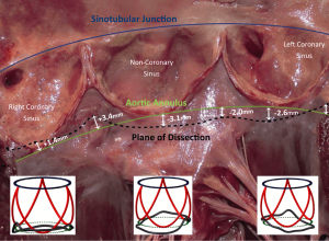 Click on image to zoom