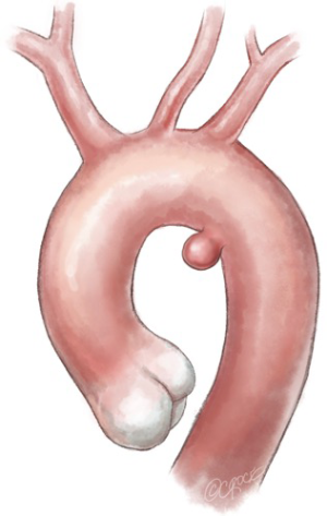 Click on image to zoom