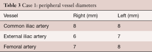 Table 3