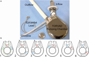 Click on image to zoom