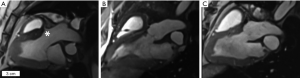 Click on image to zoom