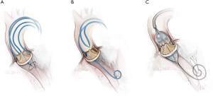 Click on image to zoom
