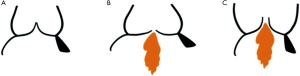 Click on image to zoom