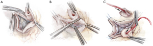 Click on image to zoom