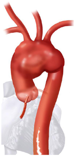Click on image to zoom