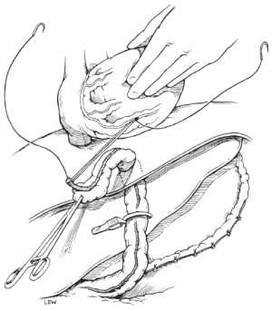Click on image to zoom