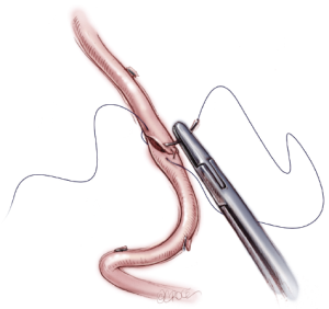 Click on image to zoom