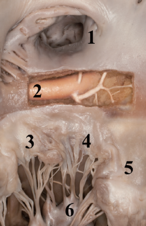 Click on image to zoom