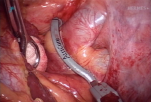 Click on image to zoom