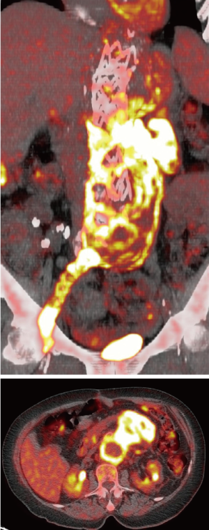 Click on image to zoom