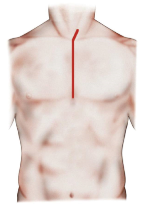 Click on image to zoom