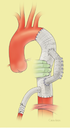 Click on image to zoom