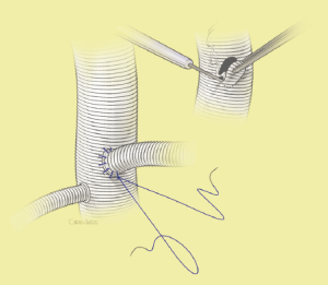 Click on image to zoom