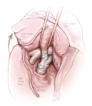Click on image to zoom Figure