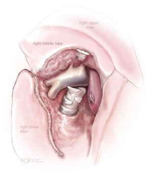 Click on image to zoom Figure