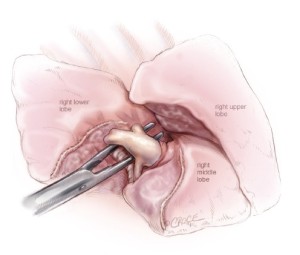 Click on image to zoom Figure
