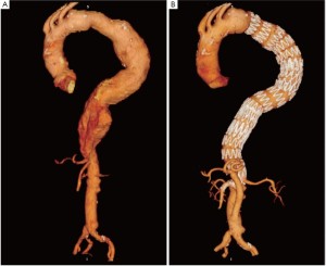 Click on image to zoom Figure 4