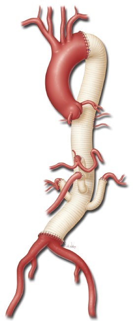 Click on image to zoom Figure 11