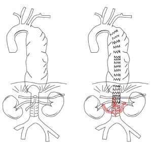 Figure 31