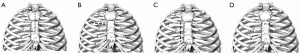 Click on image to zoom