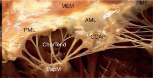 Click on image to zoom