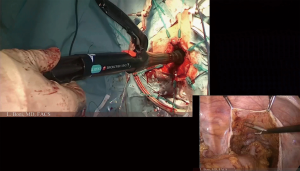 Click on image to zoom