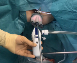 Click on image to zoom