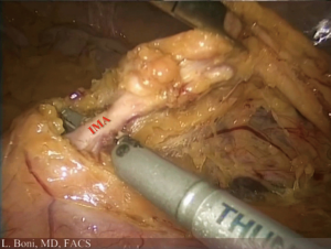 Click on image to zoom