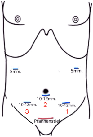 Click on image to zoom