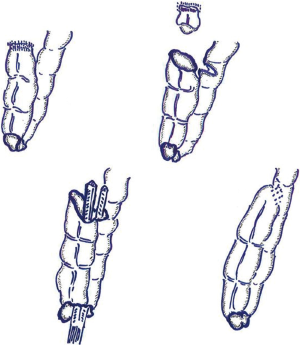 Click on image to zoom