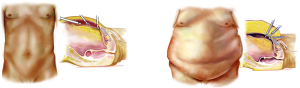 Click on image to zoom