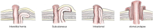 Click on image to zoom