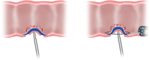 Click on image to zoom