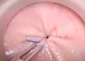 Click on image to zoom